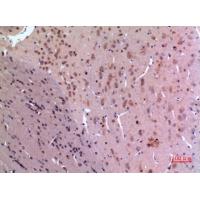 GDI-2 Polyclonal Antibody