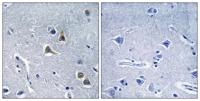 ARRDC2 Polyclonal Antibody