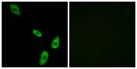 AR-α1B Polyclonal Antibody
