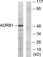 AR-β1 Polyclonal Antibody