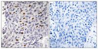 ATF-1 Polyclonal Antibody