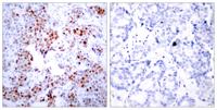 ATF-2 Polyclonal Antibody