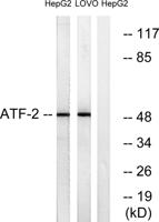 ATF-2 Polyclonal Antibody