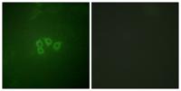 eIF4B Polyclonal Antibody