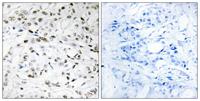 Elongin A1 Polyclonal Antibody