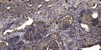 Elongin A3 Polyclonal Antibody