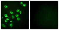 Endoplasmin Polyclonal Antibody