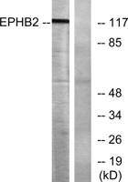 EphB2 Polyclonal Antibody