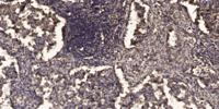 Atg4D Polyclonal Antibody