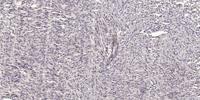 Eps8L2 Polyclonal Antibody