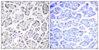 ATP5G3 Polyclonal Antibody