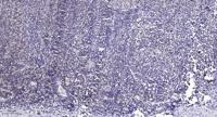 ERAP1 Polyclonal Antibody
