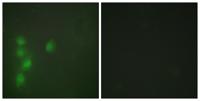 AW-1 Polyclonal Antibody