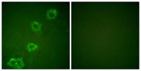BACE Polyclonal Antibody