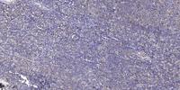 BACH1 Polyclonal Antibody