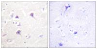 ErbB-4 Polyclonal Antibody