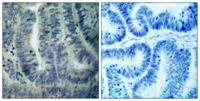 Bad Polyclonal Antibody