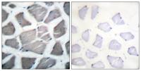 Bak Polyclonal Antibody