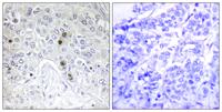 B-ATF Polyclonal Antibody
