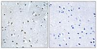 POLDIP3 Polyclonal Antibody