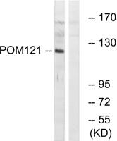 POM121 Polyclonal Antibody
