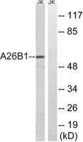 POTE15 Polyclonal Antibody