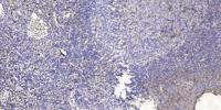 POTE15 Polyclonal Antibody