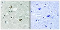 Girdin Polyclonal Antibody