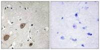 BEGAIN Polyclonal Antibody