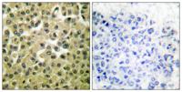 Mcl-1 Polyclonal Antibody