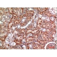 M-CSF Polyclonal Antibody