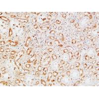 M-CSF Polyclonal Antibody