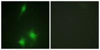 MDM2 Polyclonal Antibody