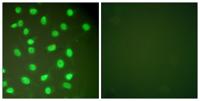 BM28 Polyclonal Antibody