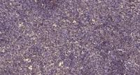 Atm Polyclonal Antibody