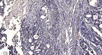 MCH-2R Polyclonal Antibody