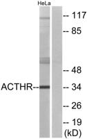 MC2-R Polyclonal Antibody