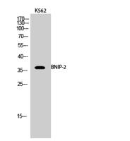 BNIP-2 Polyclonal Antibody