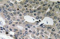 BNIP-2 Polyclonal Antibody
