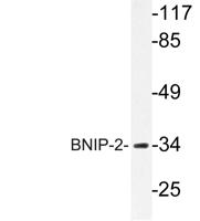 BNIP-2 Polyclonal Antibody