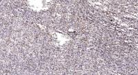 BRAF35 Polyclonal Antibody