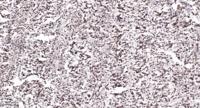 BRD3 Polyclonal Antibody