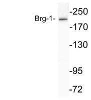 Brg-1 Polyclonal Antibody