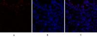 C/EBP β Polyclonal Antibody
