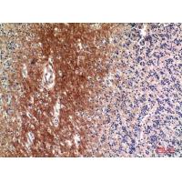 C4a/b Polyclonal Antibody
