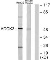 CABC1 Polyclonal Antibody