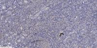 CABC1 Polyclonal Antibody