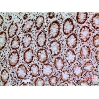 CacyBP Polyclonal Antibody