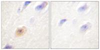 CAS Polyclonal Antibody