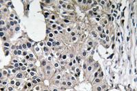 Caspase-7 Polyclonal Antibody
